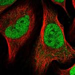 NAC1 Polyclonal Antibody