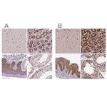 NAC1 Antibody in Immunohistochemistry (Paraffin) (IHC (P))