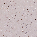 NAC1 Antibody in Immunohistochemistry (Paraffin) (IHC (P))