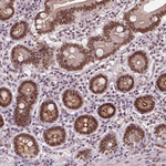 NAC1 Antibody in Immunohistochemistry (Paraffin) (IHC (P))