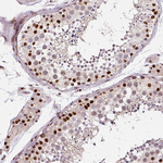 NAC1 Antibody in Immunohistochemistry (Paraffin) (IHC (P))