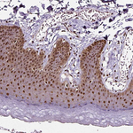 NAC1 Antibody in Immunohistochemistry (Paraffin) (IHC (P))