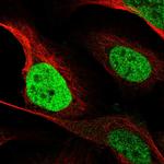 C/EBP beta Antibody in Immunocytochemistry (ICC/IF)
