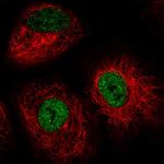 IRF2BP2 Polyclonal Antibody