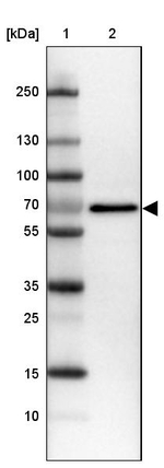 IGF2BP1 Antibody in Western Blot (WB)