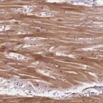 SMYD1 Antibody in Immunohistochemistry (Paraffin) (IHC (P))