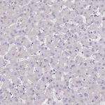 SMYD1 Antibody in Immunohistochemistry (Paraffin) (IHC (P))