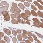 SMYD1 Antibody in Immunohistochemistry (Paraffin) (IHC (P))