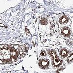 Prosapip2 Antibody in Immunohistochemistry (Paraffin) (IHC (P))