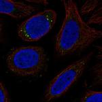 CYP27C1 Polyclonal Antibody