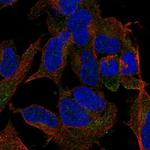 TMEM169 Polyclonal Antibody
