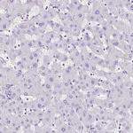 TCF3 Antibody in Immunohistochemistry (Paraffin) (IHC (P))