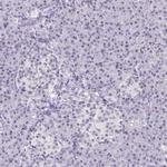 TCF3 Antibody in Immunohistochemistry (Paraffin) (IHC (P))