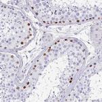 TCF3 Antibody in Immunohistochemistry (Paraffin) (IHC (P))