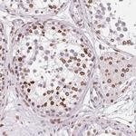 Lamin B2 Antibody in Immunohistochemistry (Paraffin) (IHC (P))