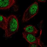 Znf672 Antibody in Immunocytochemistry (ICC/IF)