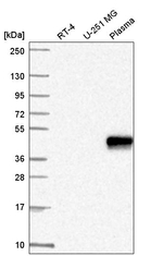 Znf672 Antibody in Western Blot (WB)