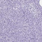 HMGB3 Antibody in Immunohistochemistry (Paraffin) (IHC (P))