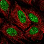 SERCA2 ATPase Polyclonal Antibody