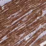 SERCA2 ATPase Antibody in Immunohistochemistry (Paraffin) (IHC (P))