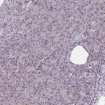 SERCA2 ATPase Antibody in Immunohistochemistry (Paraffin) (IHC (P))
