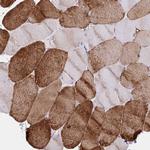 SERCA2 ATPase Antibody in Immunohistochemistry (Paraffin) (IHC (P))