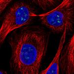 FTSJ3 Polyclonal Antibody