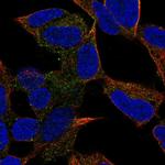 PCDH20 Polyclonal Antibody