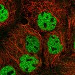 ORAOV1 Polyclonal Antibody