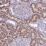 GDF5OS Polyclonal Antibody