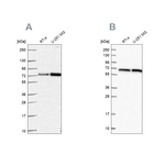 DLAT Antibody in Western Blot (WB)
