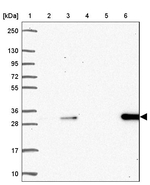 DCK Antibody in Western Blot (WB)