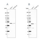 DOK7 Antibody in Western Blot (WB)