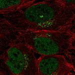 SPSB4 Polyclonal Antibody