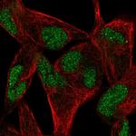 TNFRSF19L Polyclonal Antibody