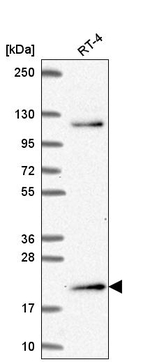 MSC Antibody in Western Blot (WB)