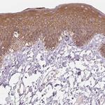 Cytokeratin 1 Polyclonal Antibody