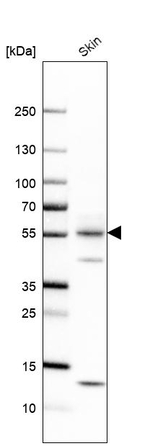 Cytokeratin 1 Antibody in Western Blot (WB)