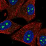 PPIL1 Polyclonal Antibody