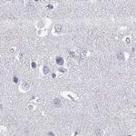 Connexin 50 Antibody in Immunohistochemistry (Paraffin) (IHC (P))