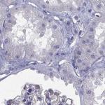 Connexin 50 Antibody in Immunohistochemistry (Paraffin) (IHC (P))