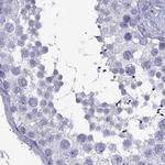 Connexin 50 Antibody in Immunohistochemistry (Paraffin) (IHC (P))