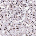 EWSR1 Antibody in Immunohistochemistry (Paraffin) (IHC (P))