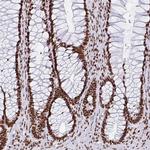 EWSR1 Antibody in Immunohistochemistry (Paraffin) (IHC (P))