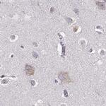 BFSP2 Antibody in Immunohistochemistry (Paraffin) (IHC (P))