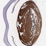 BFSP2 Antibody in Immunohistochemistry (Paraffin) (IHC (P))