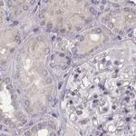 BFSP2 Antibody in Immunohistochemistry (Paraffin) (IHC (P))