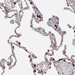 Acetyl-CoA Carboxylase Antibody in Immunohistochemistry (Paraffin) (IHC (P))