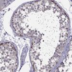 HSFX1 Antibody in Immunohistochemistry (Paraffin) (IHC (P))
