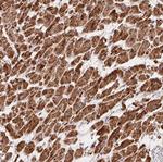 GBAS Antibody in Immunohistochemistry (Paraffin) (IHC (P))